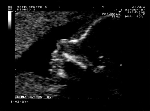 echo-3-1-small.jpg